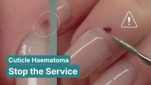 Close-up of cuticle haematoma with e-file bit approaching nail, showing when to stop any nail service - professional nail safety education by Radina Ignatova