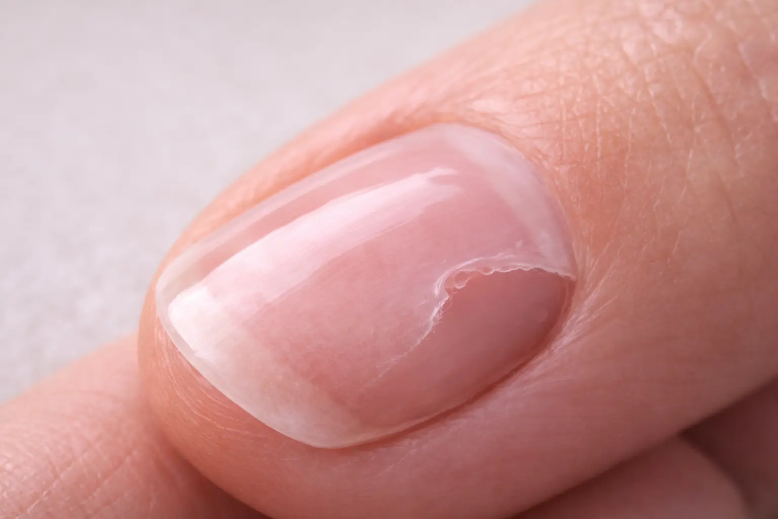 Gel polish lifting after 3 days showing nail prep problems and adhesion failure