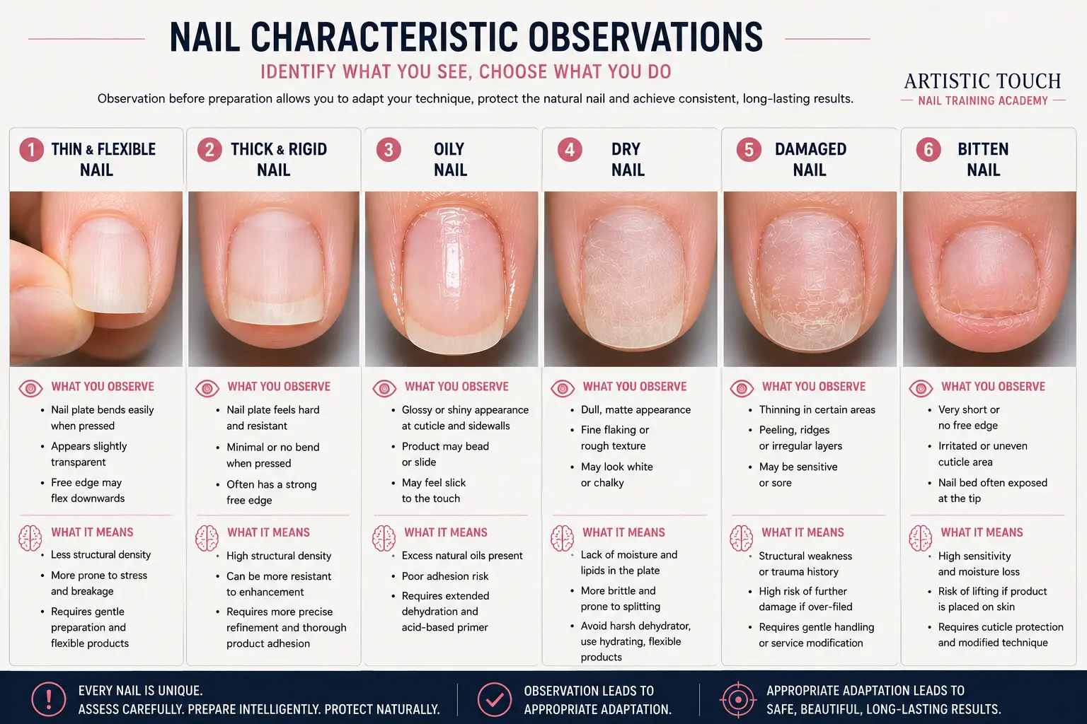 Educational guide showing six observable nail characteristics: flexible versus rigid, oily versus dry, damage indicators, cuticle condition, growth patterns and assessment of service suitability