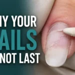 Nail lifting near the cuticle showing product separation and retention failure explained in the Nail Prep Course by Radina Ignatova