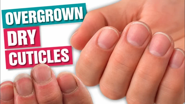 Russian Manicure on Overgrown, Dry Cuticles: A Real Client Case