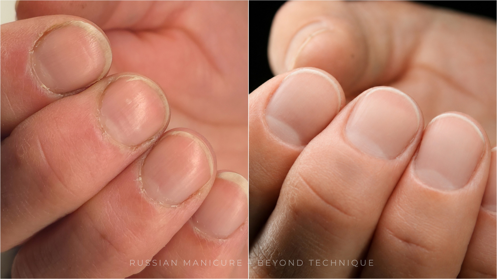 Russian Manicure before and after on a dry overgrown cuticle showing the result after professional cuticle work